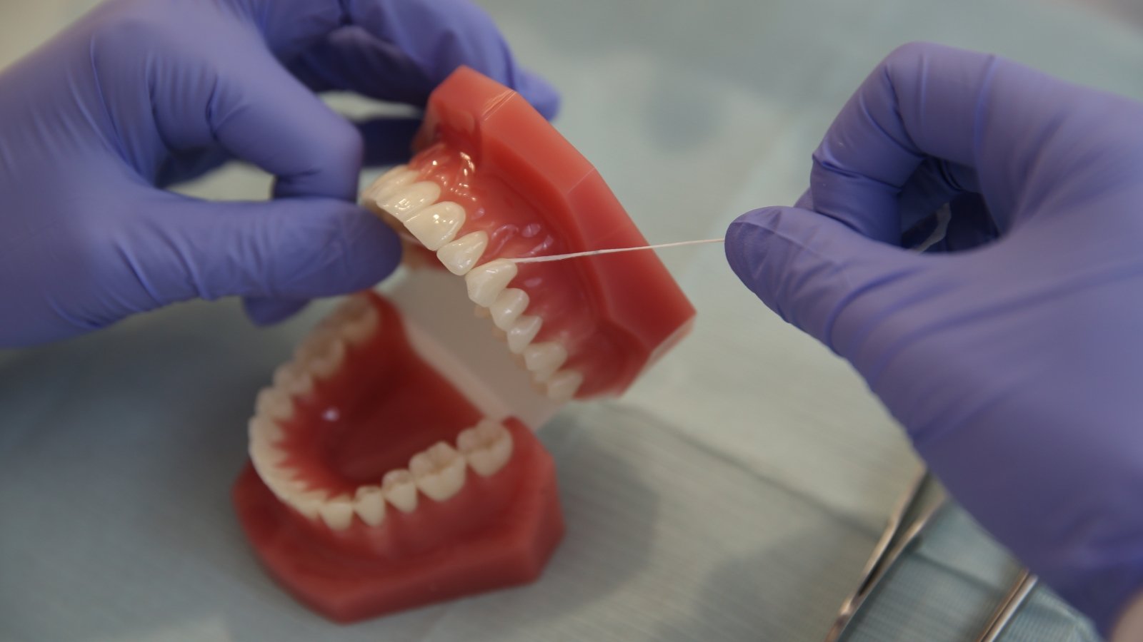 Denture Cleaning Service