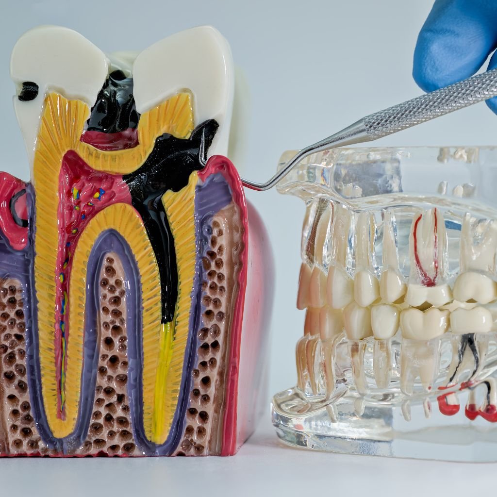 Periodontal gum disease treatment being carried out by a dental hygienist